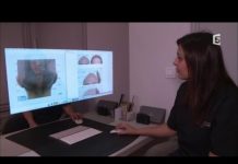 Que valent les implants capillaires ? Implants-capillaires-quest-ce-que-ca-vaut-