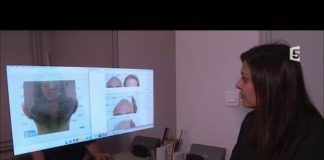 Que valent les implants capillaires ? Implants-capillaires-quest-ce-que-ca-vaut-