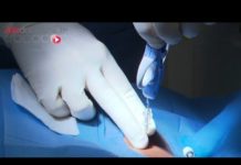 Etablir le diagnostic de lymphome Lymphome-etablir-le-diagnostic-