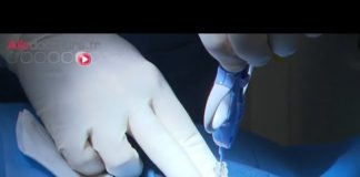 Etablir le diagnostic de lymphome Lymphome-etablir-le-diagnostic-