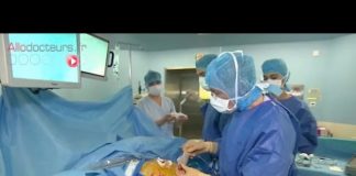 La cholécystectomie ou l’ablation de la vésicule lors de calculs biliaires Calculs-biliaires-lablation-de-la-vesicule-cholecystectomie-Allo-Docteurs