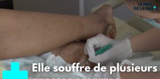 Escarres : comment les soigner ? Comment-soigner-les-escarres-