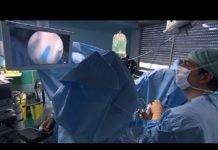 La chirurgie au laser de l’adénome de la prostate Adenome-de-la-prostate-la-chirurgie-au-laser-Allo-Docteurs