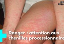 Attention aux chenilles processionnaires ! Chenilles-processionnaires-attention-danger-