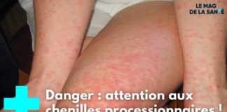 Attention aux chenilles processionnaires ! Chenilles-processionnaires-attention-danger-