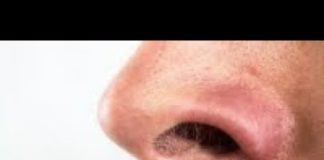 Comment se débarrasser des poils de nez disgracieux ? Comment-se-debarrasser-des-poils-de-nez-disgracieux-