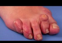 Que faire quand on a honte de ses orteils ? Jai-honte-de-mes-orteils-que-faire-