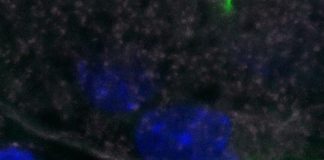 Pourquoi certaines souches de listeria sont-elle hypervirulentes ? Listeria-pourquoi-certaines-souches-sont-hypervirulentes