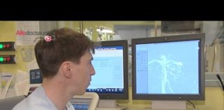 Soigner une rupture d’anévrisme sans ouvrir le crâne Rupture-danevrisme-soigner-le-cerveau-sans-ouvrir-le-crane-Allo-Docteurs