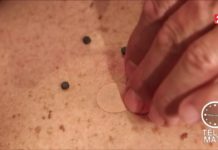 La thérapie par les aimants Sante-Ces-aimants-qui-nous-veulent-du-bien