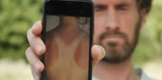 Comment éviter les coups de soleil ? Sante-Comment-eviter-les-coups-de-soleil-