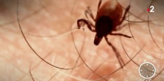 Comment se protéger contre la maladie de Lyme ? Sante-Maladie-de-Lyme-comment-se-proteger-et-shabiller-