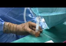 Comment se déroule le prélèvement des ovocytes en cas de don ? Don-dovocytes-comment-se-deroule-le-prelevement-des-ovocytes-L