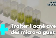 Micro-algues : des pouvoirs extraordinaires Les-pouvoirs-extraordinaires-des-micro-algues-