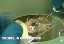 Un nouveau traitement contre le cholestérol Sante-Cholesterol-un-nouveau-traitement