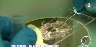 Un nouveau traitement contre le cholestérol Sante-Cholesterol-un-nouveau-traitement