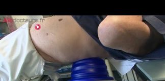 Détruire les calculs rénaux grâce à une onde de choc Une-onde-de-choc-pour-detruire-les-calculs-renaux-Allo-Docteurs