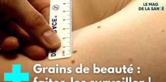 Pallier le manque de dermatologues par un robot Un-robot-pour-pallier-le-manque-de-dermatologues-