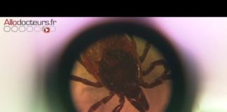 Traquer les tiques pour lutter contre la maladie de Lyme Maladie-de-Lyme-des-chercheurs-traqueurs-de-tiques-Allo-Docteurs
