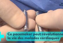 Le pacemaker dernière génération Pacemaker-derniere-generation-une-revolution-Le-Mag-de-la-Sante