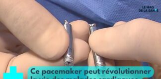 Le pacemaker dernière génération Pacemaker-derniere-generation-une-revolution-Le-Mag-de-la-Sante