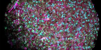 Les puces seront-elles bientôt remplacées par des neurones vivants dans les ordinateurs biologiques ? Ordinateurs-biologiques-pourra-t-on-bientot-remplacer-les-puces-par-des-neurones-vivants-