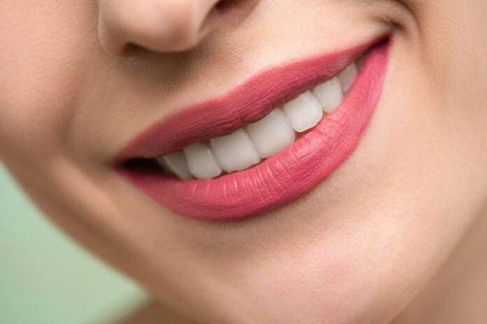 Les facettes dentaires en Hongrie: sourire radieux à moindre coût