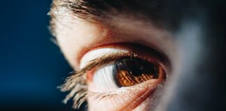 D’où viennent les cernes ? D'où viennent les cernes ?