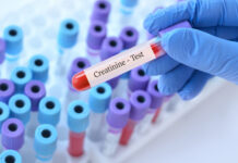 Créatinine : comprendre les valeurs standards et les signaux d’alerte Doctor holding a test blood sample tube with Creatinine test on the background of medical test tubes with analyzes.