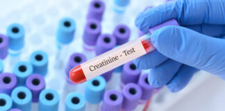 Créatinine : comprendre les valeurs standards et les signaux d’alerte Doctor holding a test blood sample tube with Creatinine test on the background of medical test tubes with analyzes.